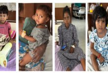 CG News : चार मासूमों को मिला नया जीवन, जहरीले सांप के डसने से शरीर हो रहा था लकवाग्रस्त