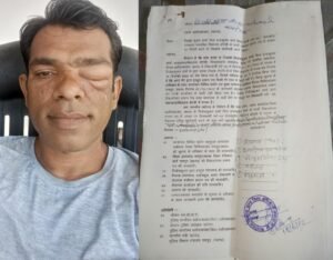 गांव में विवाद के बाद आरोप-प्रत्यारोप तेज, पुलिस प्रशासन की मदद करने वाले व्यक्ति को बदनाम करने की कोशिश का आरोप